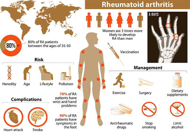 What is rheumatoid arthritis?