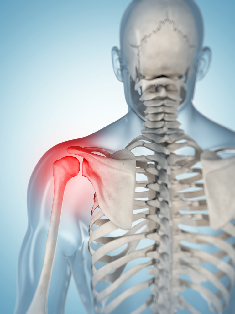 Shoulder Pain Rotator Cuff Injury